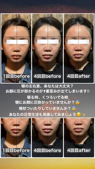 💎後悔させない小顔 矯正💎イトヤマ🌱のエステ・リラクイメージ