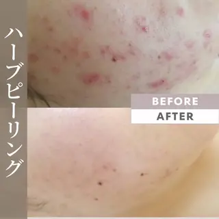 Lilas所属・迫原 麻衣のエステ・リラクイメージ