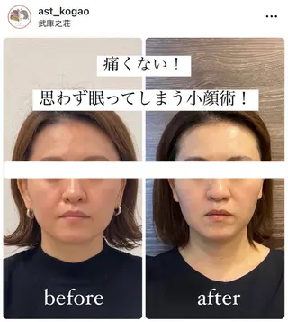 小顔矯正サロンAST【アスト】所属・小顔矯正サロン AST【アスト】のその他イメージ