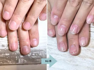 ネイル 深爪矯正・自爪育成 ネイルサロンアモここのネイルデザイン