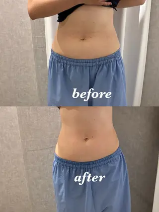 メンズ 腸活サポート みなみののエステ・リラクイメージ