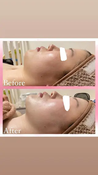 salon〜RePCa〜(サロンルピカ)所属・山﨑 藍のエステ・リラクイメージ