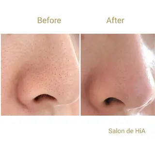 Salon de  HiAのエステ・リラクイメージ