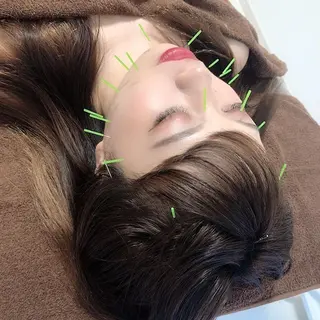 心斎橋痩身ダイエット 韓国.美容鍼.小顔のエステ・リラクイメージ