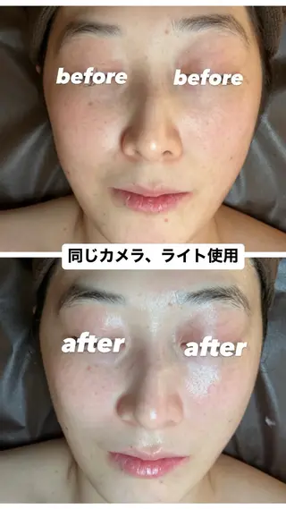 chouchou【シュシュ】所属・トータルボディケア chouchouのエステ・リラクイメージ