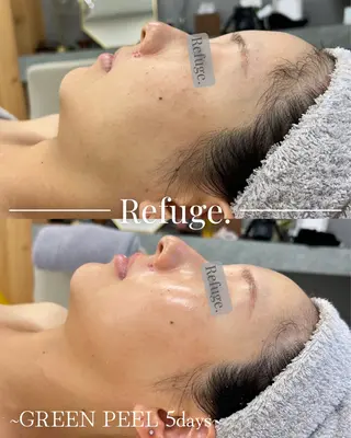 グリーンピール専門サロン Refuge.所属・Refuge. （リフュージュ）のエステ・リラクイメージ