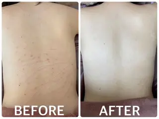 ハーブピーリング 横浜のエステ・リラクイメージ