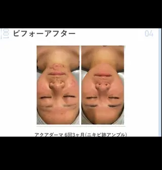 看護師が施術する美容 サロン/HIDAKAのエステ・リラクイメージ