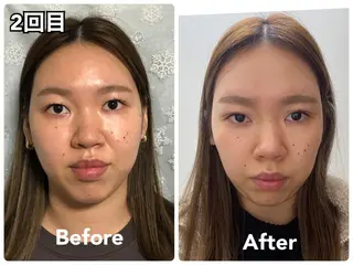 スターローズ所属・小顔矯正サロン スターローズのエステ・リラクイメージ