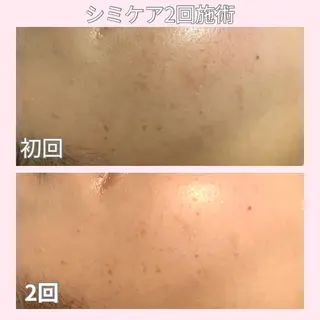 毛穴ニキビ専門 ビューティーグランツのエステ・リラクイメージ