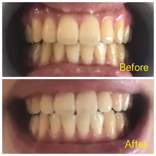 M渋谷店所属・M渋谷 ホワイトニングのエステ・リラクイメージ