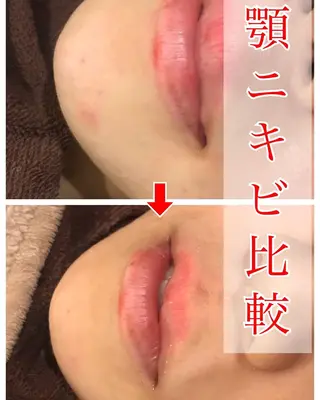 ロング カラー パーマ ヘアアレンジ メンズ キッズ ネイル マツエク・マツパ 四つ星サロン🎖 腸＆ニキビケアに特化のエステ・リラクイメージ