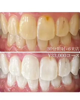 メンズ ホワイトニングルーム　川崎店所属・ホワイトニング ルーム　川崎店のその他イメージ