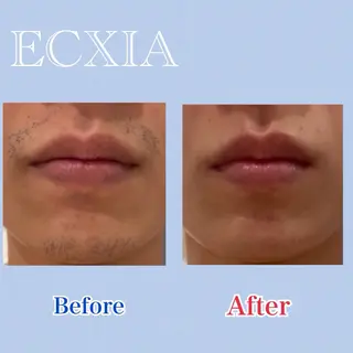 脱毛サロン ECXIA【博多】のエステ・リラクイメージ