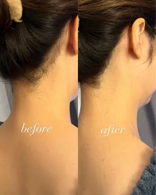 うなじ脱毛/美肌脱毛 LABELのエステ・リラクイメージ