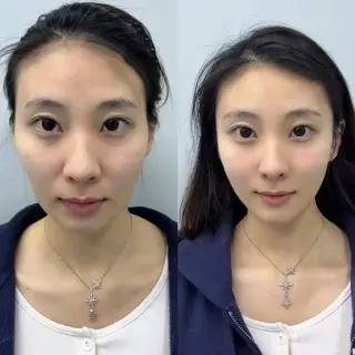 ネイル aliaハイフ&水光ジェットサロン所属・aliaハーブ水光店 エステティシャン募集のエステ・リラクイメージ