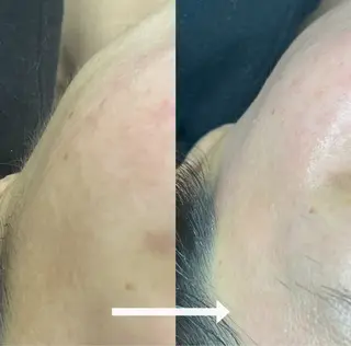 beautysalongift所属・gift あすかのマツエク・マツパデザイン