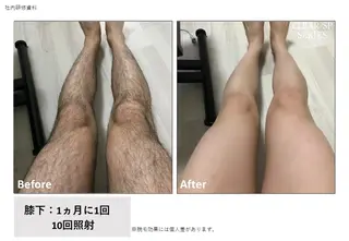 メンズ トータルビューティー サロン Lisseの眉毛・アイブロウイメージ