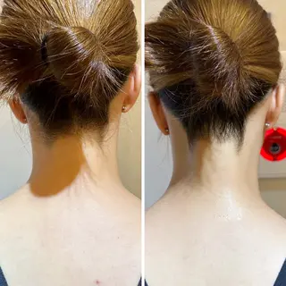 うなじ脱毛/美肌脱毛 LABELのエステ・リラクイメージ