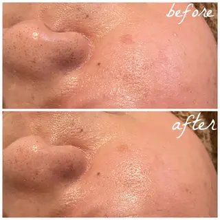 メンズ メナード岐阜市茜部 杉浦のエステ・リラクイメージ