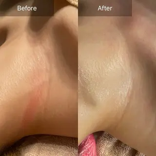 Mandarin Orange所属・毛穴から始める肌メン テマンダリンオレンジのエステ・リラクイメージ