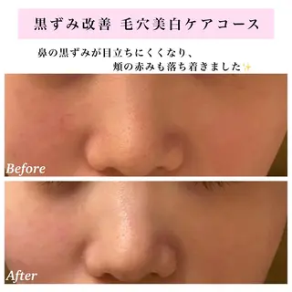 Bellesthe （ベルエステ）のエステ・リラクイメージ