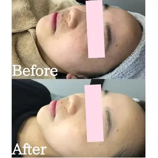 BestBelleꕤ 大阪福島/肌質改善のエステ・リラクイメージ