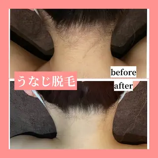 メンズ 天神【効果重視脱毛】 YouMakeのエステ・リラクイメージ