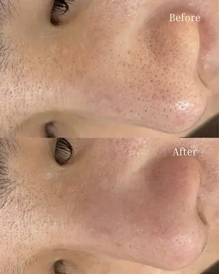 BELLIS HUIT所属・ハーブピーリング那覇 BELLISHUITのエステ・リラクイメージ