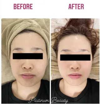 プラティーヌ ボーテのその他イメージ