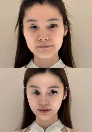 パーマ aliaハイフ&水光ジェットサロン所属・aliaハーブ水光店 エステティシャン募集のエステ・リラクイメージ