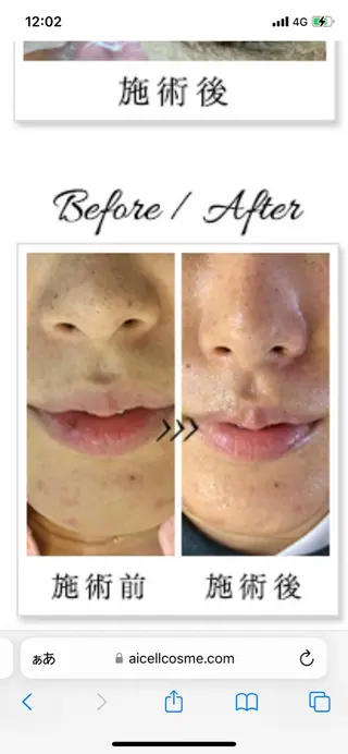 BestBelleꕤ 大阪福島/肌質改善のエステ・リラクイメージ