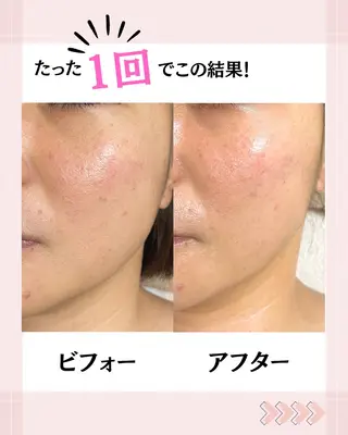 CHEERFUL-チェアフル-所属・CHEERFUL- チェアフル-山本直子のエステ・リラクイメージ