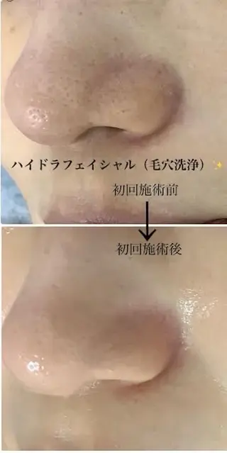 🩵Tatsumi Kana🩵のエステ・リラクイメージ