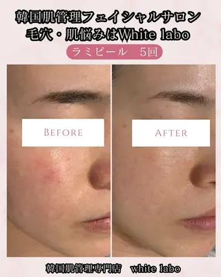 韓国肌管理専門店　White labo 梅田店所属・ホワイトラボ梅田 ｜毛穴・韓国肌管理のエステ・リラクイメージ