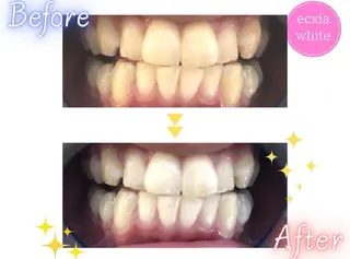 エクシア　ホワイト　宇治小倉店所属・大森 愛來のその他イメージ