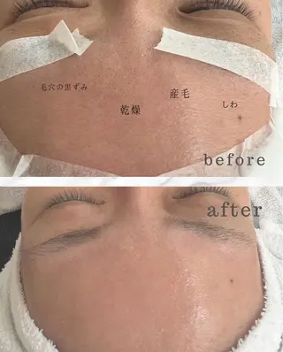 新井 てるみのエステ・リラクイメージ