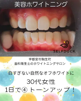 歯科提携セルフダック 宇都宮駒生店のエステ・リラクイメージ