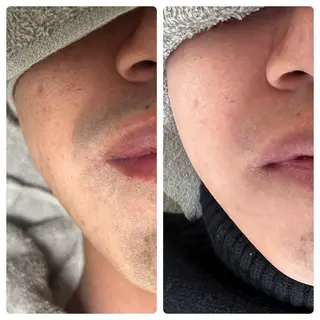 メンズ ☀️Akala☀️ メンズ脱毛のエステ・リラクイメージ