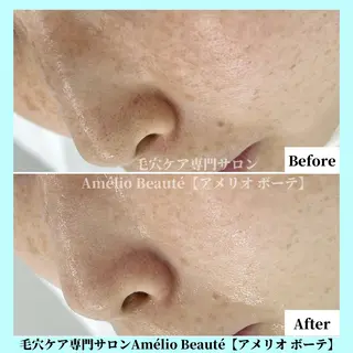 毛穴ケア専門サロン Amélio Beauté所属・毛穴ケア専門サロン アメリオボーテのその他イメージ