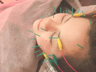 小顔美容鍼灸Acubelle Yakuin.【アキュベル薬院】所属・石川 真梨奈  美容鍼灸/アロマのエステ・リラクイメージ