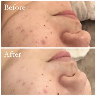 ララ/ハーブ メゾンリュバンのエステ・リラクイメージ