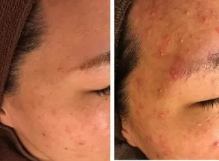 ミディアム カラー パーマ ヘアアレンジ メンズ キッズ ネイル マツエク・マツパ ニキビ・肌質改善専門 ♡人生が変わるサロンのエステ・リラクイメージ