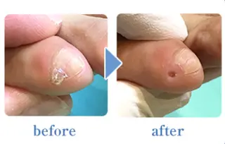 巻き爪補正店 横浜関内店のネイルデザイン