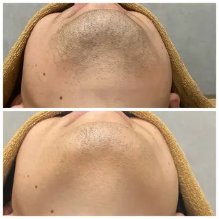 メンズ ヘアーサロンいしざわ所属・いしざわ /メンズ脱毛サロンのエステ・リラクイメージ