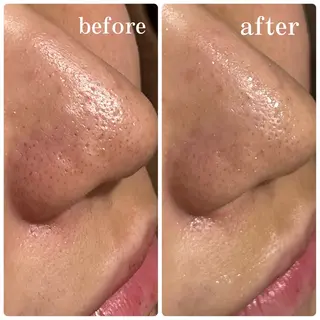 Folche所属・Folcheはません 森山のエステ・リラクイメージ