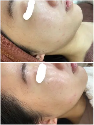 肌質改善ワックス専門 yukiのエステ・リラクイメージ