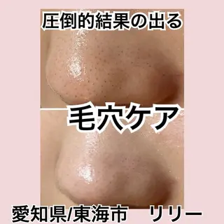 トータルビューティー サロンLilyのエステ・リラクイメージ