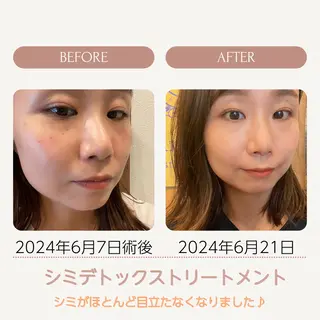 vary  clue MISAのエステ・リラクイメージ