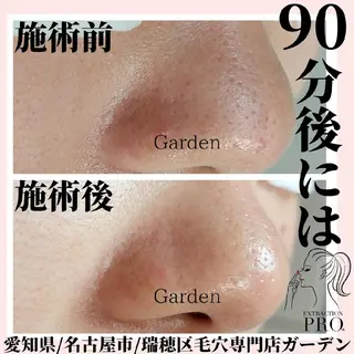 プライベートサロン Gardenのエステ・リラクイメージ